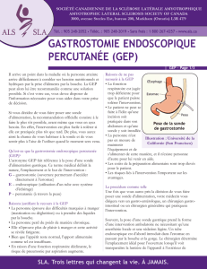 PEG_FactSheet_French