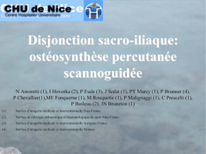 Disjonction sacro-iliaque