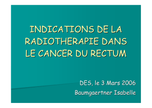 cancer du rectum et radiothérapie