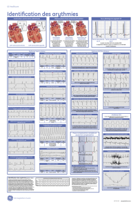 Poster2_Arrhythmia Recognition_f