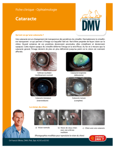 Cataracte - Centre DMV