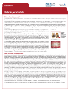 Maladie parodontale - Clinique Dentaire Gervais Et Associés