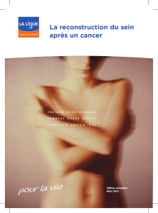 La reconstruction du sein après un cancer mars 2016