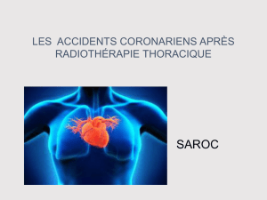 les accidents coronariens après radiothérapie thoracique