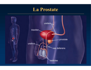 Dépistage et diagnostic