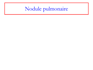 Nodule pulmonaire