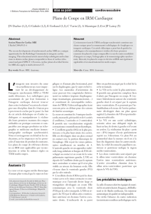 Plans de Coupe en IRM Cardiaque - Association I