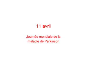 Parkinson - Outre