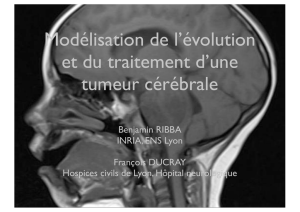 Modélisation de l`évolution et du traitement d`une tumeur cérébrale