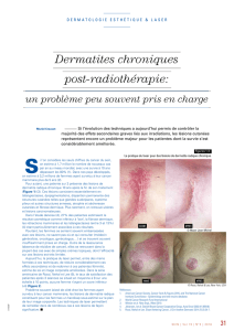 Dermatites chroniques post-radiothérapie