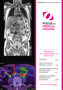 RECIDIVE DU CANCER DE LA PROSTATE