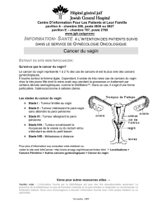 Cancer du vagin