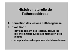 Histoire naturelle de l`athérosclérose