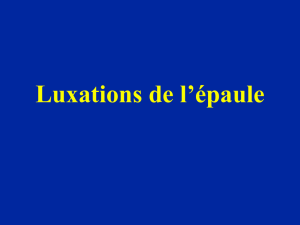 03- Epaule Luxations IFSI