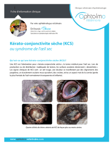 Kérato-conjonctivite sèche (KCS) ou syndrome de l`œil sec