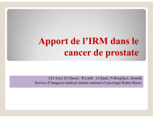 Apport de l`IRM dans le cancer de prostate