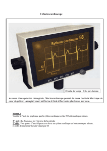 L`électrocardioscope - Physique Chimie Caen