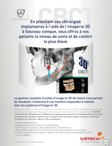 En planifiant vos chirurgies implantaires à l`aide de l`imagerie 3D à