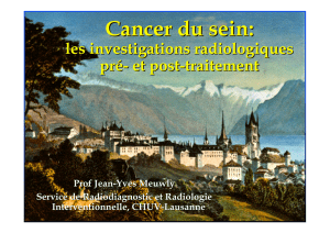 cancer sein investigations radiologiques pre post traitement