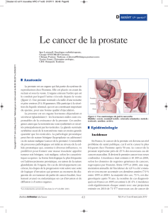 Le cancer de la prostate