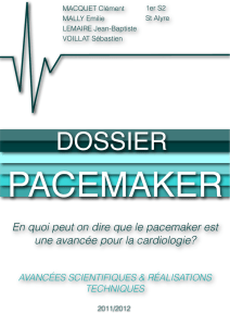 pacemaker.tpe