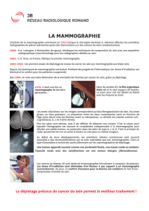 Poster sur la mammographie - Groupe 3R, Réseau Radiologique
