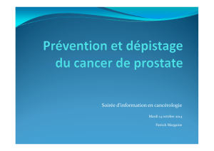 Prévention et dépistage du cancer de la prostate