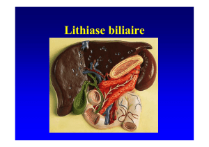 Lithiase biliaire
