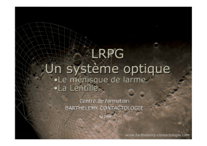 LRPG Un système optique