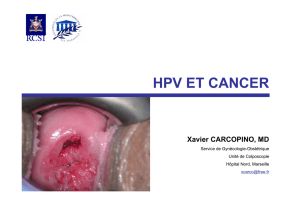 hpv et cancer - Infectiologie