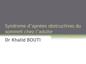 Syndrome d`apnées obstructives du sommeil chez l`adulte Dr Khalid