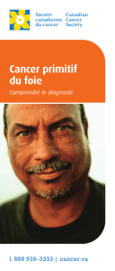 Cancer primitif du foie : Comprendre le diagnostic