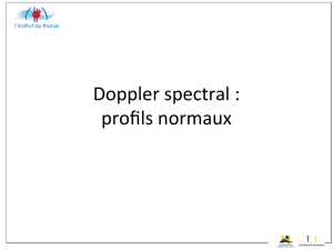 Doppler spectral : profils normaux