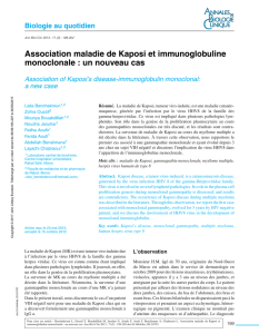 Association maladie de Kaposi et immunoglobuline monoclonale