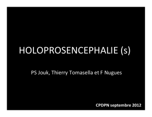 Holoprosencéphalies