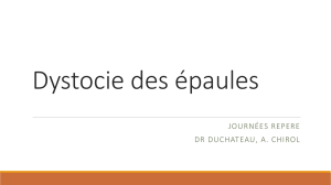 Dystocie des épaules - Dr DUCHATEAU, CHIROL A.