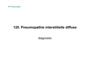 120. Pneumopathie interstitielle diffuse : diagnostic