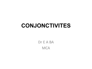 Conjonctivite