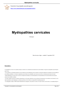 Myélopathies cervicales - L`encyclopédie neurochirurgicale