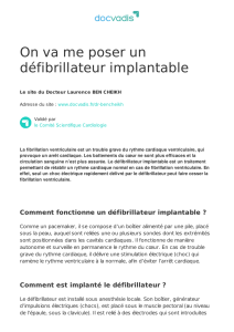 On va me poser un défibrillateur implantable