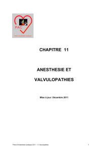 411 Valvulopathies - Précis d`anesthésie cardiaque