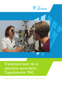Traitement laser de la cataracte secondaire