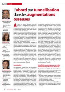 L`abordpar tunnellisation dans les augmentations