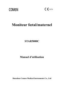 Chapitre IV Spécifications de paramètres et précautions