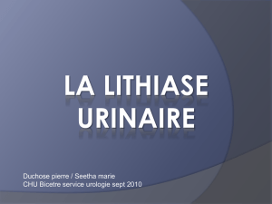 la lithiase urinaire
