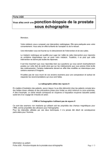 ponction de la prostate [UG5] - Société Française de Radiologie