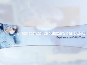L` assistance circulatoire par ECMO