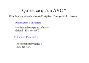 AVC IDE 2015 - Centre Hospitalier de Carcassonne