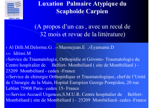 Luxation Palmaire Atypique du Scaphoïde Carpien (A