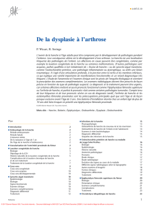 De la dysplasie à l`arthrose